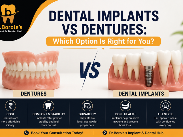 Dentures vs Dental Implants: Which Option Is Right for You?