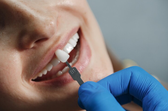 teeth check