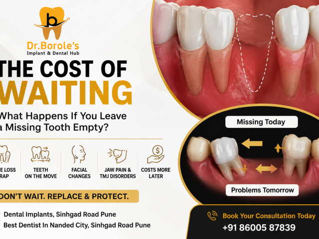 The Cost of Waiting: What Happens If You Leave a Missing Tooth Empty?
